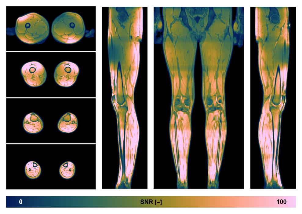 The SNR distribution of the dixon data.