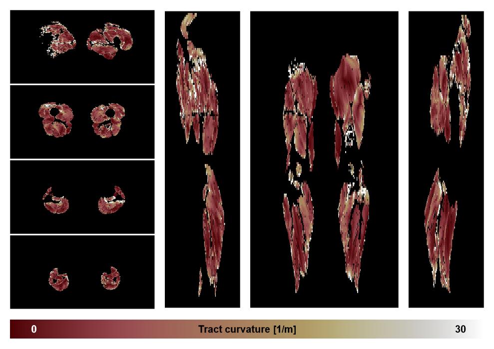 Muscle fiber tract curvature map based on whole leg DTI based fiber tractography.