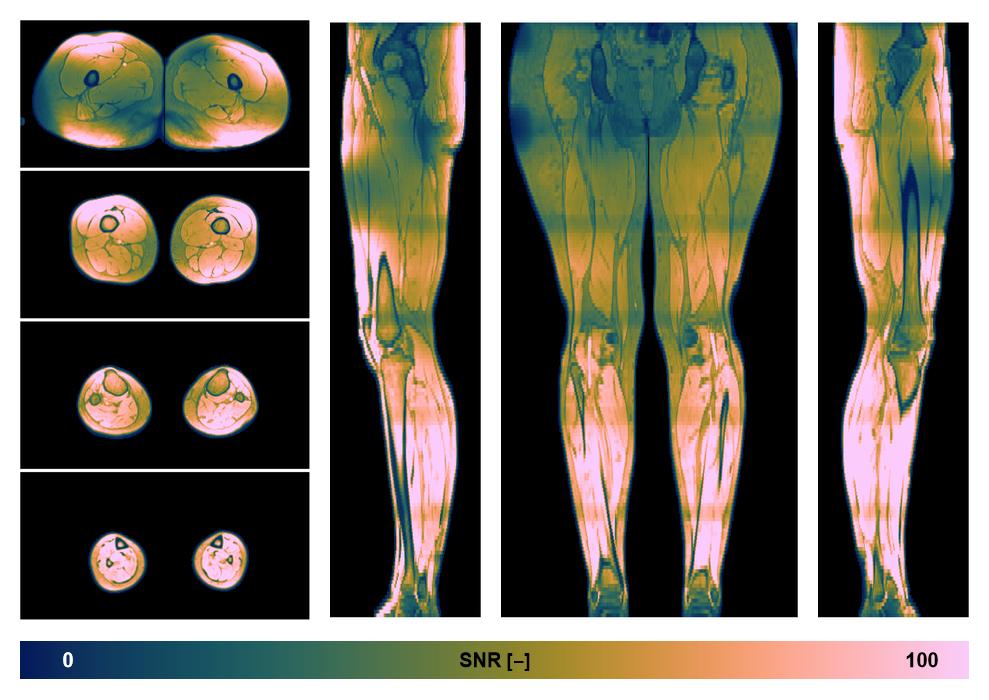 The SNR distribution of the dixon data.