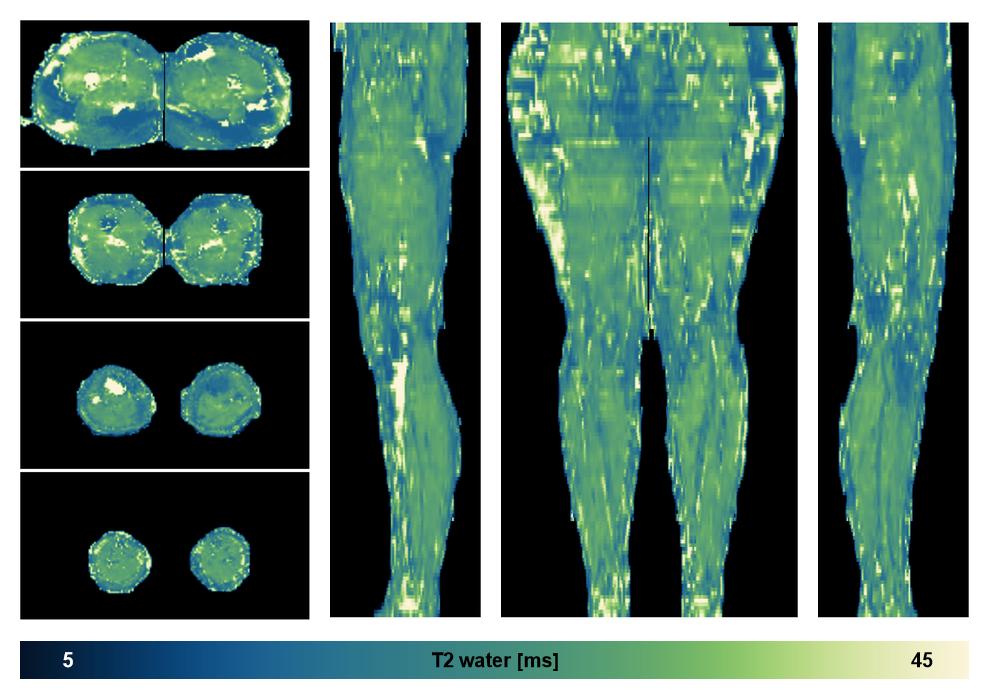 The water only T2 relaxation time of the lower extremity obtained from multi echo spin echo t2 mapping with EPG based reconstruction.