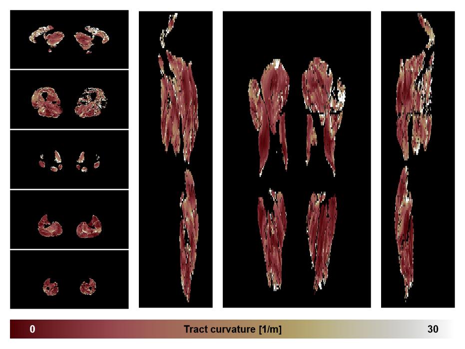 Muscle fiber tract curvature map based on whole leg DTI based fiber tractography.
