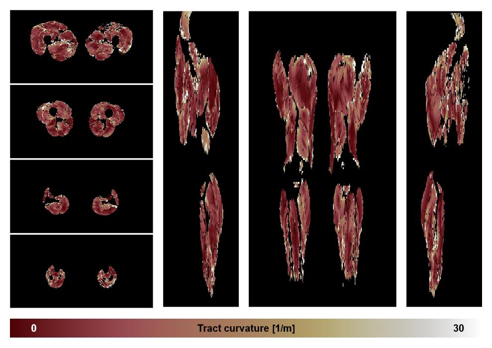Muscle fiber tract curvature map based on whole leg DTI based fiber tractography.