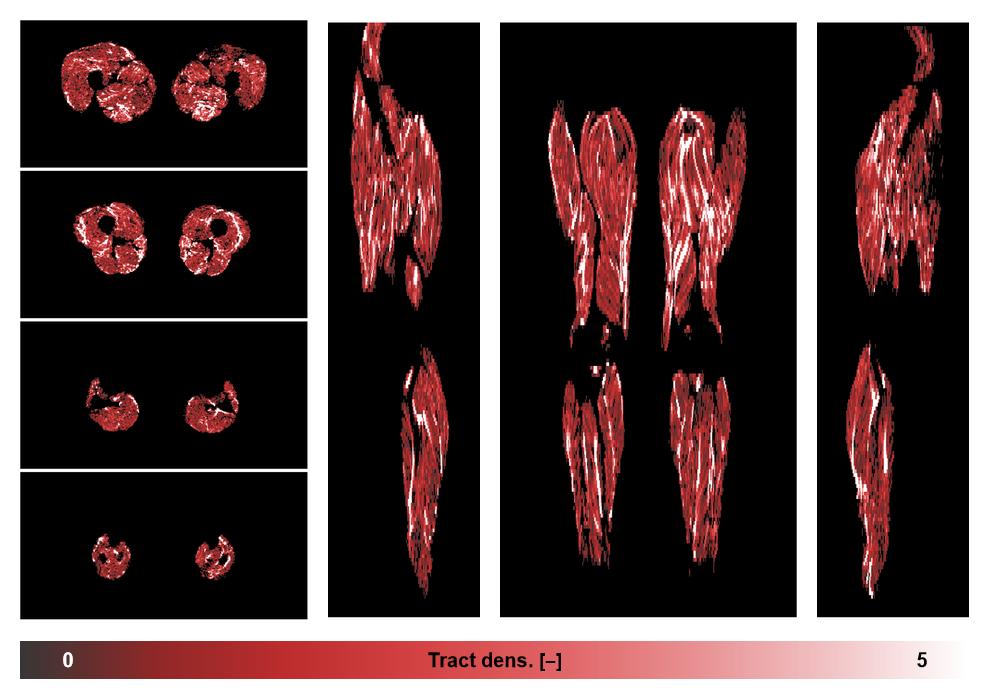 Muscle fiber tract density map based on whole leg DTI based fiber tractography.
