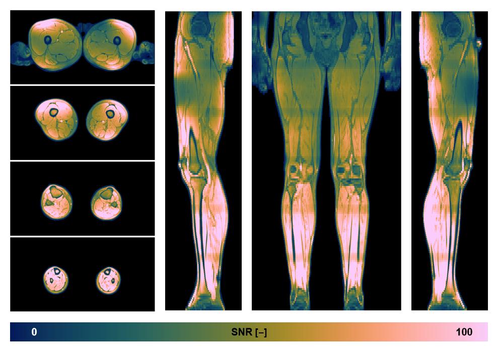 The SNR distribution of the dixon data.