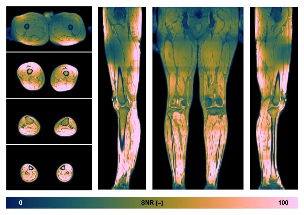 The SNR distribution of the dixon data.