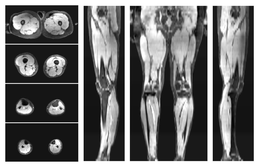 The water part of the acquired multi-echo spin echo data.