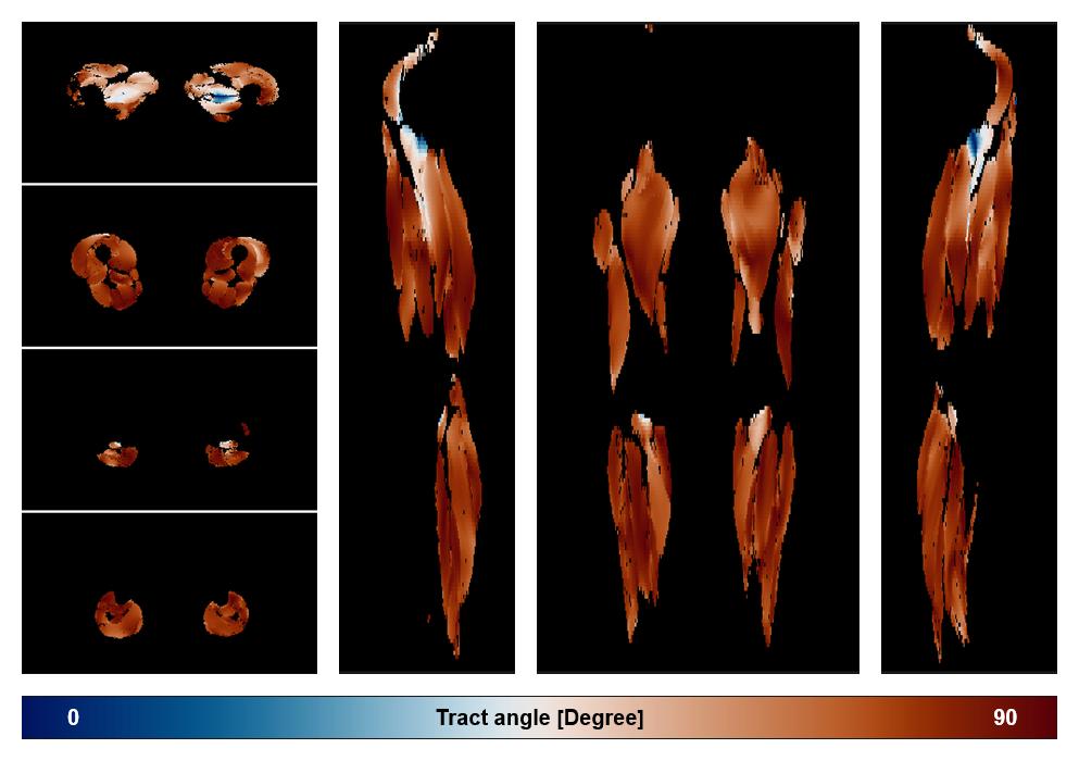 Muscle fiber tract angle map based on whole leg DTI based fiber tractography.