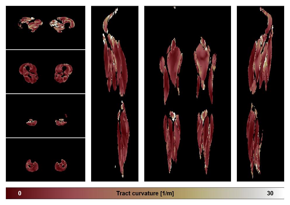 Muscle fiber tract curvature map based on whole leg DTI based fiber tractography.