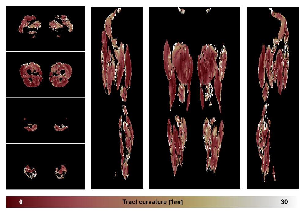 Muscle fiber tract curvature map based on whole leg DTI based fiber tractography.