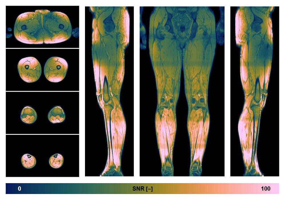 The SNR distribution of the dixon data.