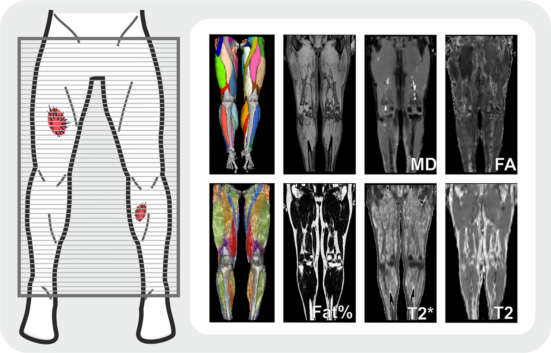 Bilateral acquisition of quantitative muscle MRI data of the whole leg