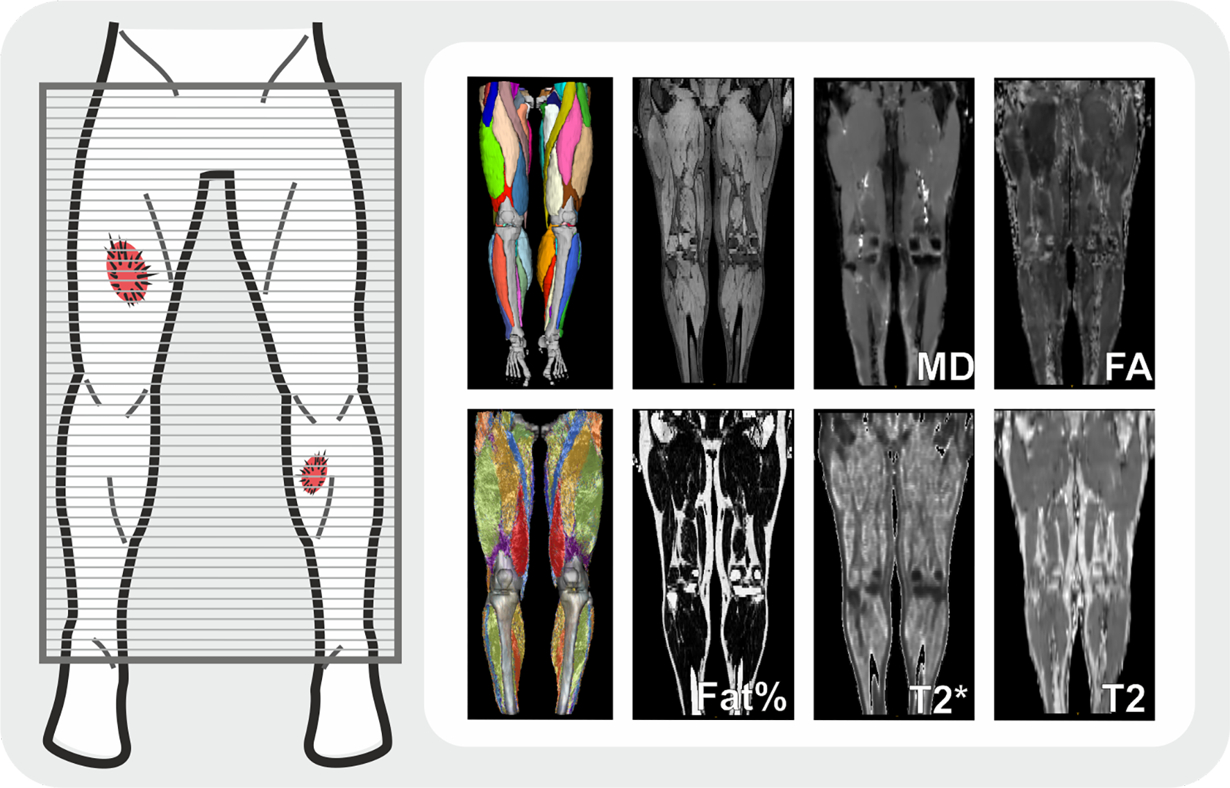 De MRI scans die uitgevoerd gaan worden