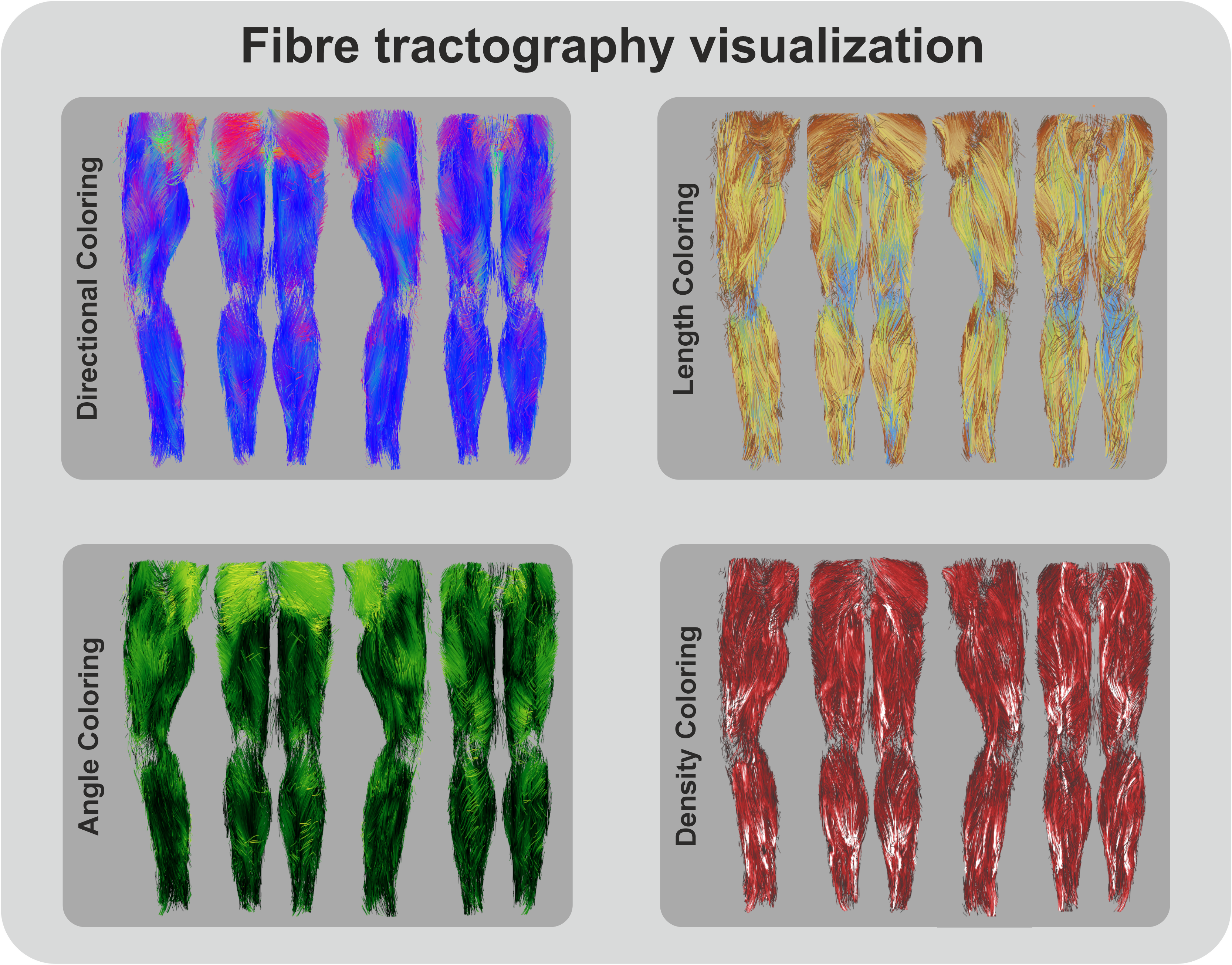 Whole leg Diffusion tensor imaging based muscle fiber tractography with color encoding